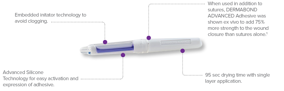 Step-by-Step Guide for Effective Application of DERMABOND PRINEO Skin  Closure System