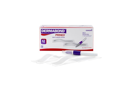 DERMABOND PRINEO Violet Skin Closure System 42cm