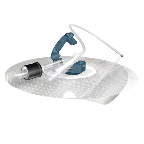 Ugo Fix Gentle Catheter Easy-to-Apply Clip - Box/5