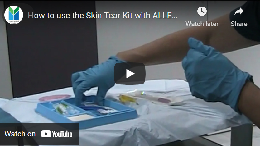 How to use allevyn skin tear kit.jpg